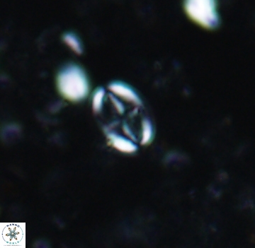Broinsonia staytonae 1106