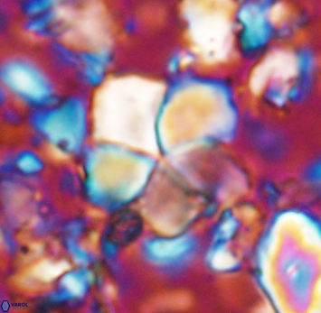 Braarudosphaera cf africana 6990