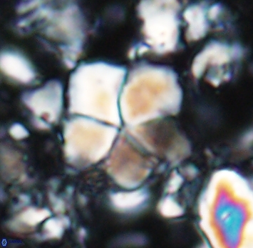 Braarudosphaera cf africana 6991