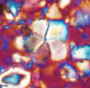 Braarudosphaera cf africana 6993