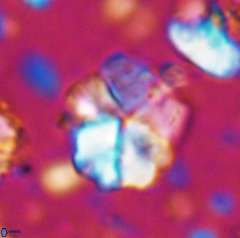 Braarudosphaera cf africana 7561