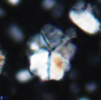 Braarudosphaera cf africana 7562