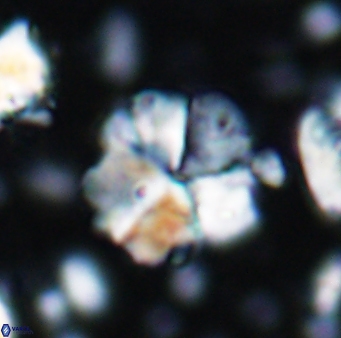 Braarudosphaera cf africana 7563