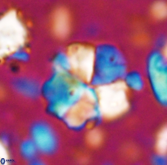 Braarudosphaera cf africana 7564