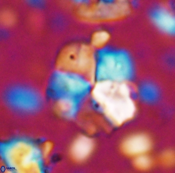 Braarudosphaera cf africana 7565