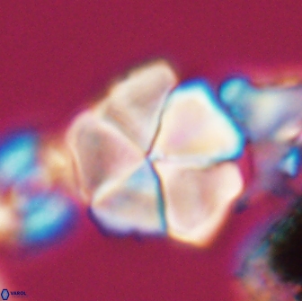 Braarudosphaera cf bigelowii 13635