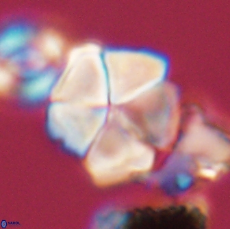 Braarudosphaera cf bigelowii 13636