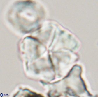 Braarudosphaera cf bigelowii 13640