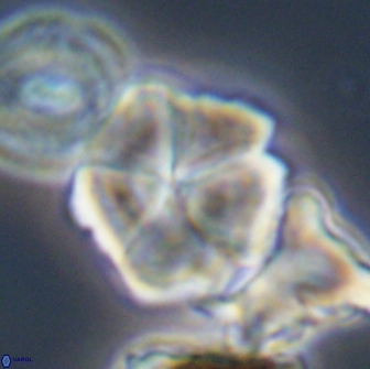 Braarudosphaera cf bigelowii 13642