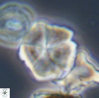 Braarudosphaera cf bigelowii 13642