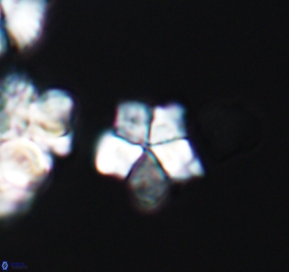 Braarudosphaera africana 10893