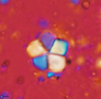 Braarudosphaera africana 962