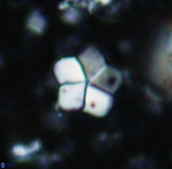 Braarudosphaera africana 985