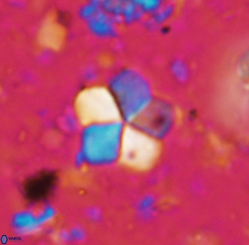 Braarudosphaera africana 986