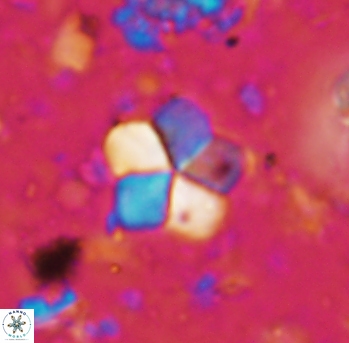 Braarudosphaera africana 986