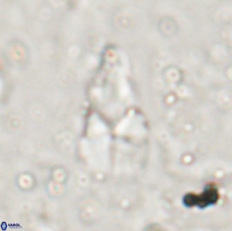 Braarudosphaera akanonistos 14401