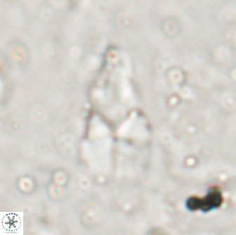 Braarudosphaera akanonistos 14401