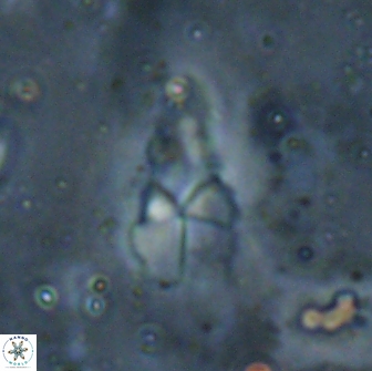 Braarudosphaera akanonistos 14403