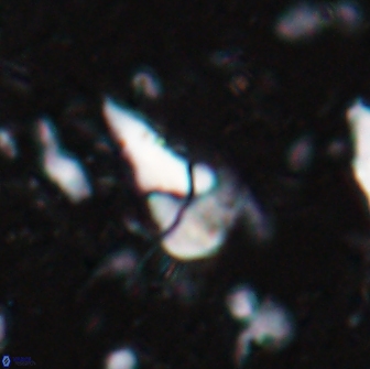 Braarudosphaera akanonistos 14315