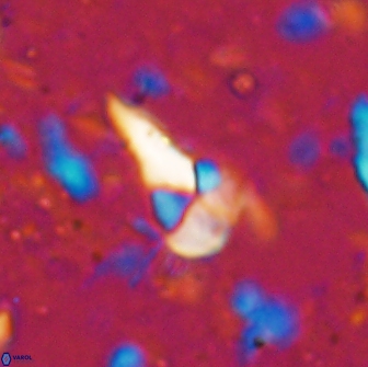 Braarudosphaera akanonistos 14317