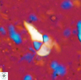 Braarudosphaera akanonistos 14317