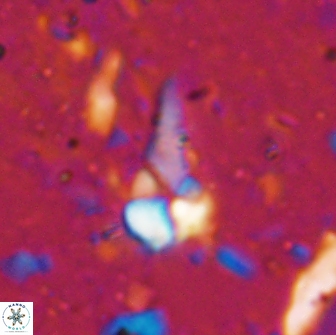 Braarudosphaera akanonistos 14318