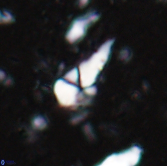 Braarudosphaera akanonistos 14320