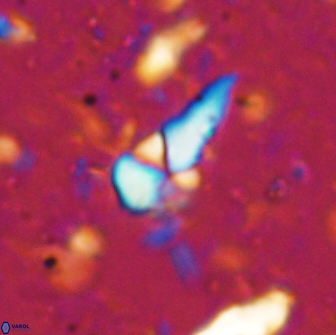 Braarudosphaera akanonistos 14321