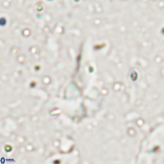 Braarudosphaera akanonistos 14322