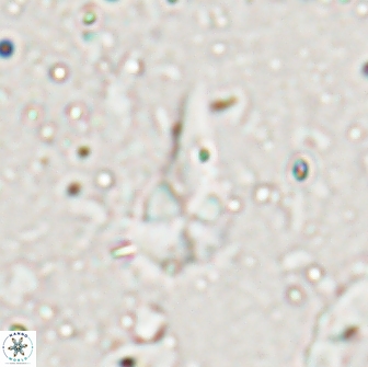 Braarudosphaera akanonistos 14322