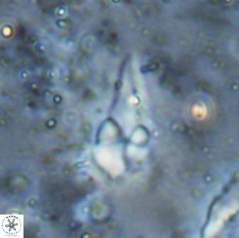 Braarudosphaera akanonistos 14323