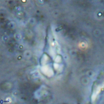 Braarudosphaera akanonistos 14324