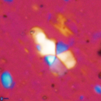 Braarudosphaera akanonistos 14396