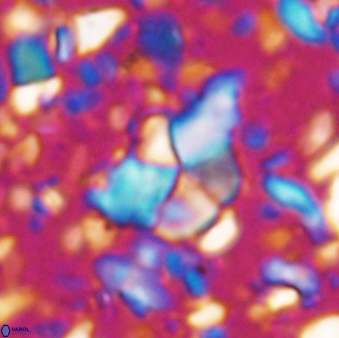 Braarudosphaera akanonistos 7552