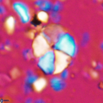 Braarudosphaera aravia 7098