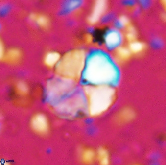 Braarudosphaera aravia 7099