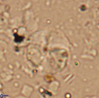 Braarudosphaera aravia 7102