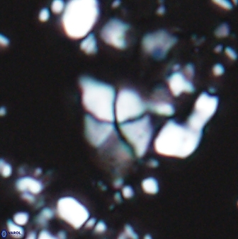 Braarudosphaera batilliformis 13167