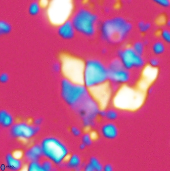 Braarudosphaera batilliformis 13168