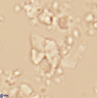 Braarudosphaera batilliformis 13173