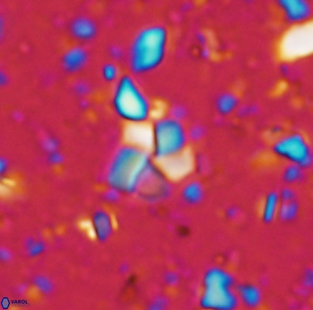 Braarudosphaera distorta 1025