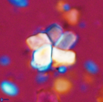 Braarudosphaera distorta 7725