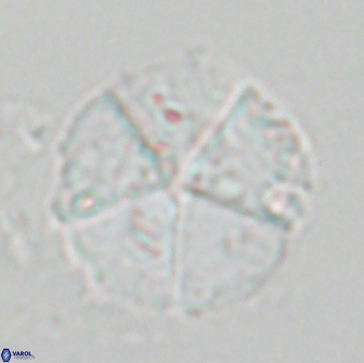 Braarudosphaera magnei 18607