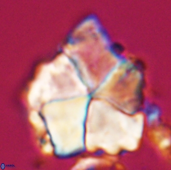 Braarudosphaera neobatilliformis 22953