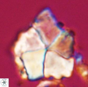 Braarudosphaera neobatilliformis 22953