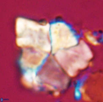 Braarudosphaera neobatilliformis 22954