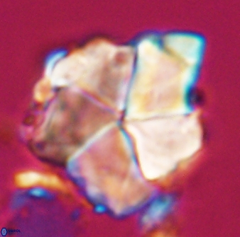 Braarudosphaera neobatilliformis 22957