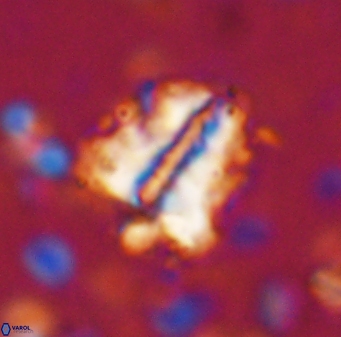 Braarudosphaera sp 3 3434