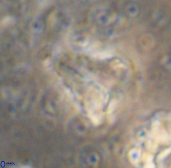 Braarudosphaera sp 1 6835