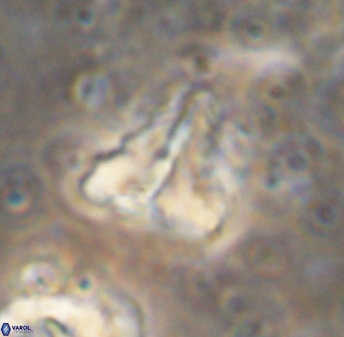 Braarudosphaera sp 1 6836